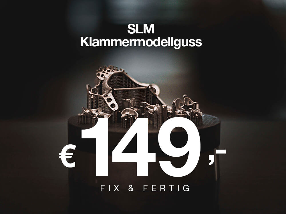 SLM Klammermodellguss